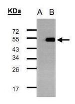 TADA3L Antibody in Western Blot (WB)
