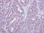 HAX1 Antibody in Immunohistochemistry (Paraffin) (IHC (P))