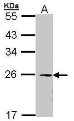 eIF3k Antibody in Western Blot (WB)