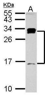 C1D Antibody in Western Blot (WB)