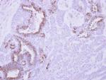 MCL-1 Antibody in Immunohistochemistry (Paraffin) (IHC (P))