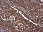 MCL-1 Antibody in Immunohistochemistry (Paraffin) (IHC (P))