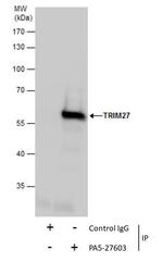 TRIM27 Antibody in Immunoprecipitation (IP)