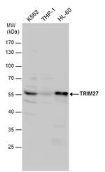 TRIM27 Antibody in Western Blot (WB)