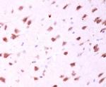 MFN2 Antibody in Immunohistochemistry (Paraffin) (IHC (P))