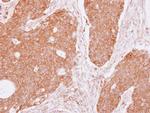 DIAPH1 Antibody in Immunohistochemistry (Paraffin) (IHC (P))