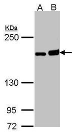 DIAPH1 Antibody in Western Blot (WB)