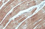 NFkB p65 Antibody in Immunohistochemistry (Paraffin) (IHC (P))