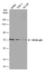 NFkB p65 Antibody in Western Blot (WB)