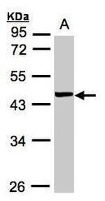 VPS72 Antibody in Western Blot (WB)
