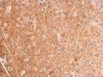 Cofilin Antibody in Immunohistochemistry (Paraffin) (IHC (P))