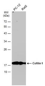 Cofilin Antibody in Western Blot (WB)