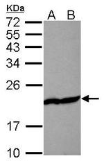 Cofilin Antibody in Western Blot (WB)