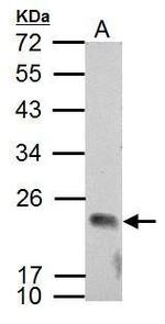 APOBEC3C Antibody in Western Blot (WB)