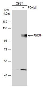 FOXM1 Antibody in Western Blot (WB)