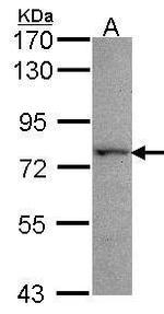 KARS Antibody in Western Blot (WB)