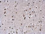 TRIM28 Antibody in Immunohistochemistry (Paraffin) (IHC (P))