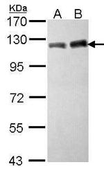 TRIM28 Antibody in Western Blot (WB)