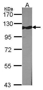 TRIM28 Antibody in Western Blot (WB)