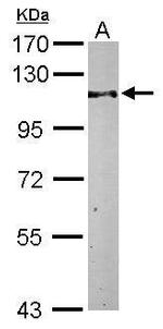 TRIM28 Antibody in Western Blot (WB)