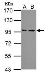 PSMD2 Antibody in Western Blot (WB)