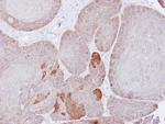 PSMD3 Antibody in Immunohistochemistry (Paraffin) (IHC (P))