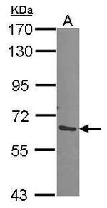 PSMD3 Antibody in Western Blot (WB)