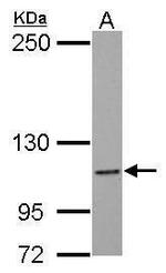 NLRC4 Antibody in Western Blot (WB)