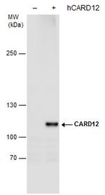 NLRC4 Antibody in Western Blot (WB)