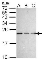 NADE Antibody in Western Blot (WB)