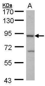Cbl-b Antibody in Western Blot (WB)