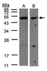 CARD8 Antibody in Western Blot (WB)