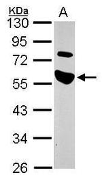 TRIP Antibody in Western Blot (WB)