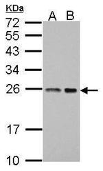 BAG2 Antibody in Western Blot (WB)