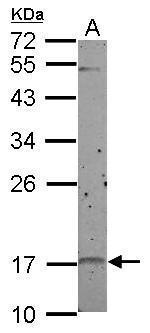 p19 INK4d Antibody in Western Blot (WB)
