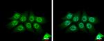 PYCARD Antibody in Immunocytochemistry (ICC/IF)