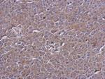 PTPN12 Antibody in Immunohistochemistry (Paraffin) (IHC (P))