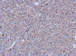 PTPN12 Antibody in Immunohistochemistry (Paraffin) (IHC (P))