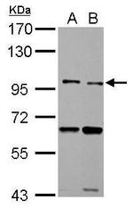 TLR5 Antibody in Western Blot (WB)