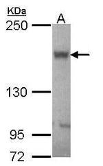 ABCB11 Antibody in Western Blot (WB)