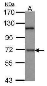 DYRK1B Antibody in Western Blot (WB)