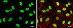 TOP2B Antibody in Immunocytochemistry (ICC/IF)