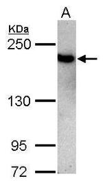 TOP2B Antibody in Western Blot (WB)