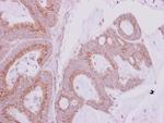 GBF1 Antibody in Immunohistochemistry (Paraffin) (IHC (P))