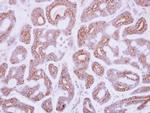 DDR2 Antibody in Immunohistochemistry (Paraffin) (IHC (P))