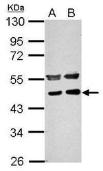 PPME1 Antibody in Western Blot (WB)