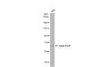 BTRC Antibody in Western Blot (WB)