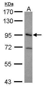 ITGB5 Antibody in Western Blot (WB)