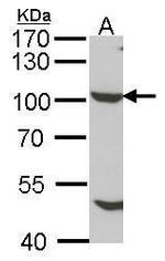 NUP98 Antibody in Western Blot (WB)