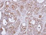 TPL2 Antibody in Immunohistochemistry (Paraffin) (IHC (P))